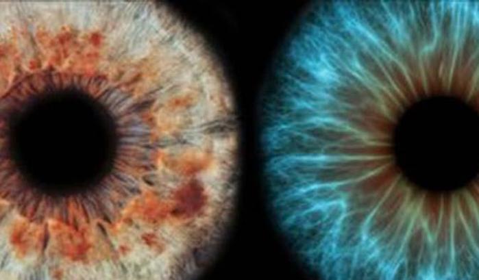 Una retina artificiale per combattere la degenerazione maculare senile